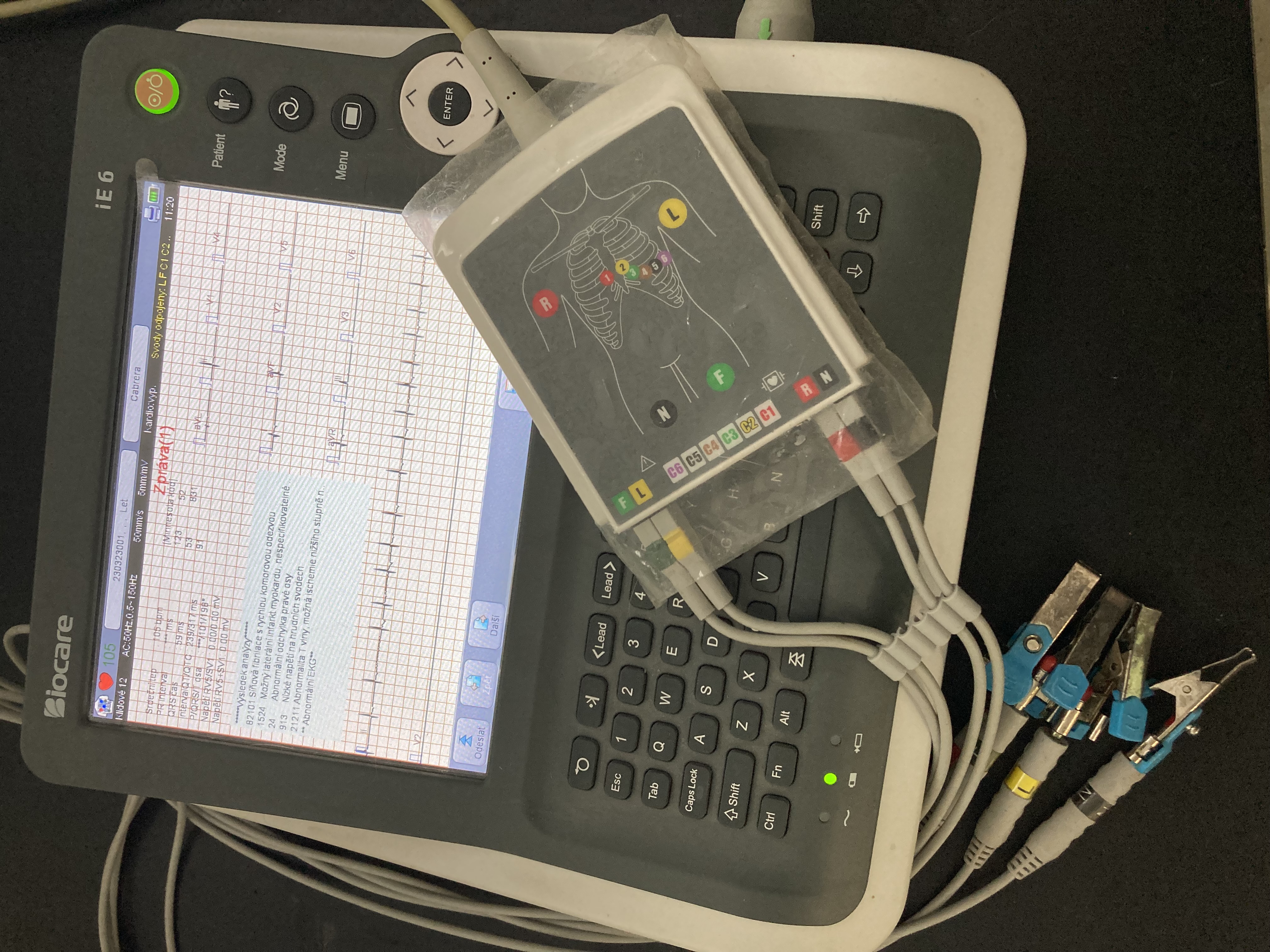 EKG přístroj Biocare iE6